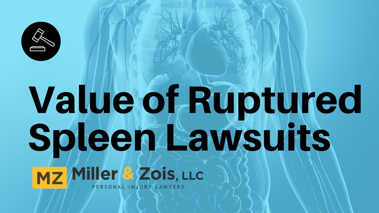 Value of Ruptured Spleen Lawsuits