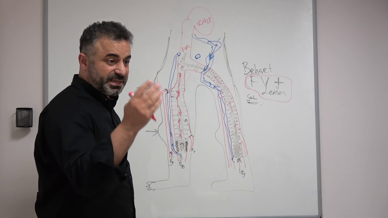 Behçet Hastalığı ve Faktör 5 Leiden sonucu  DVT - Prof. Dr. Ahmet AKGUL