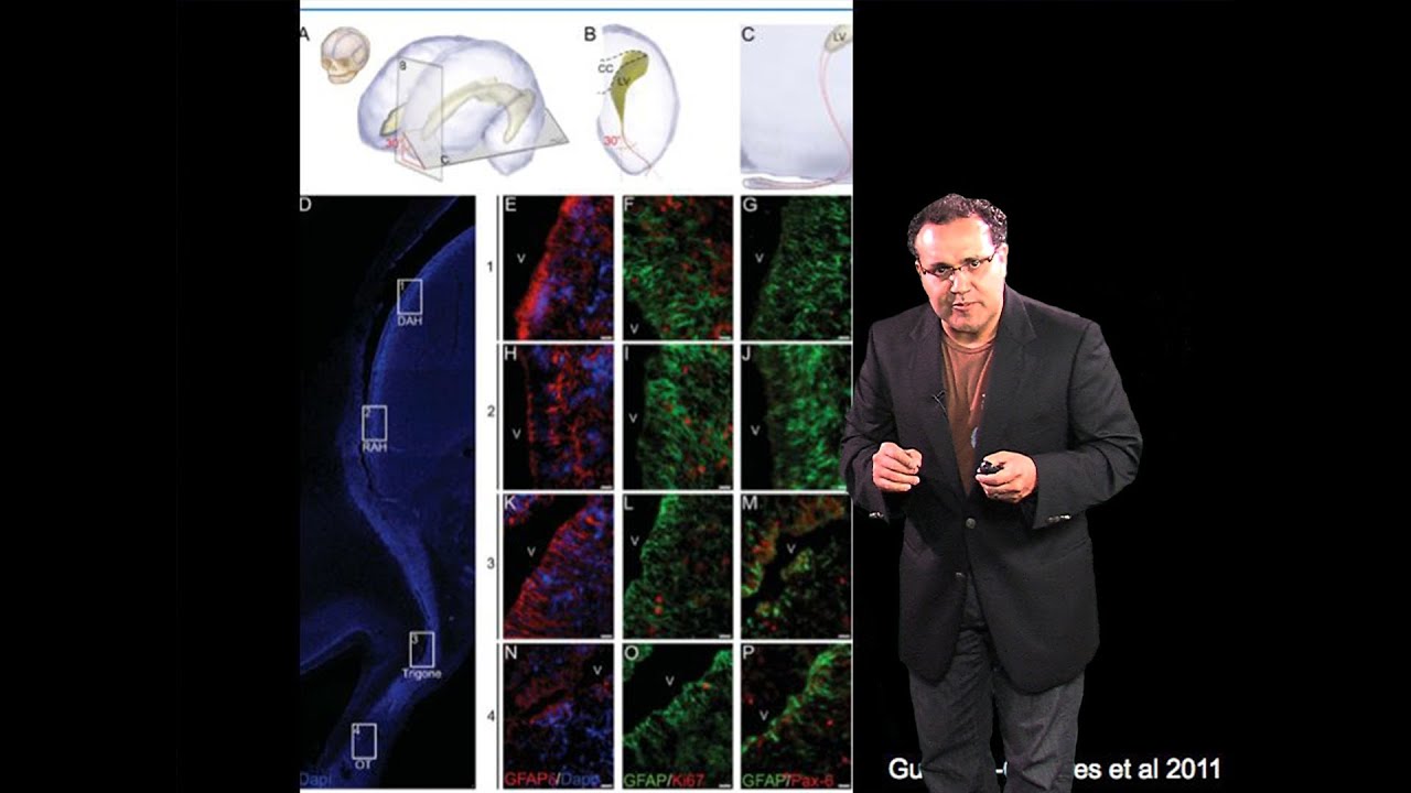 Alfredo Quiñones-Hinojosa (Johns Hopkins) Part 2: Stem Cells and Brain Tumors