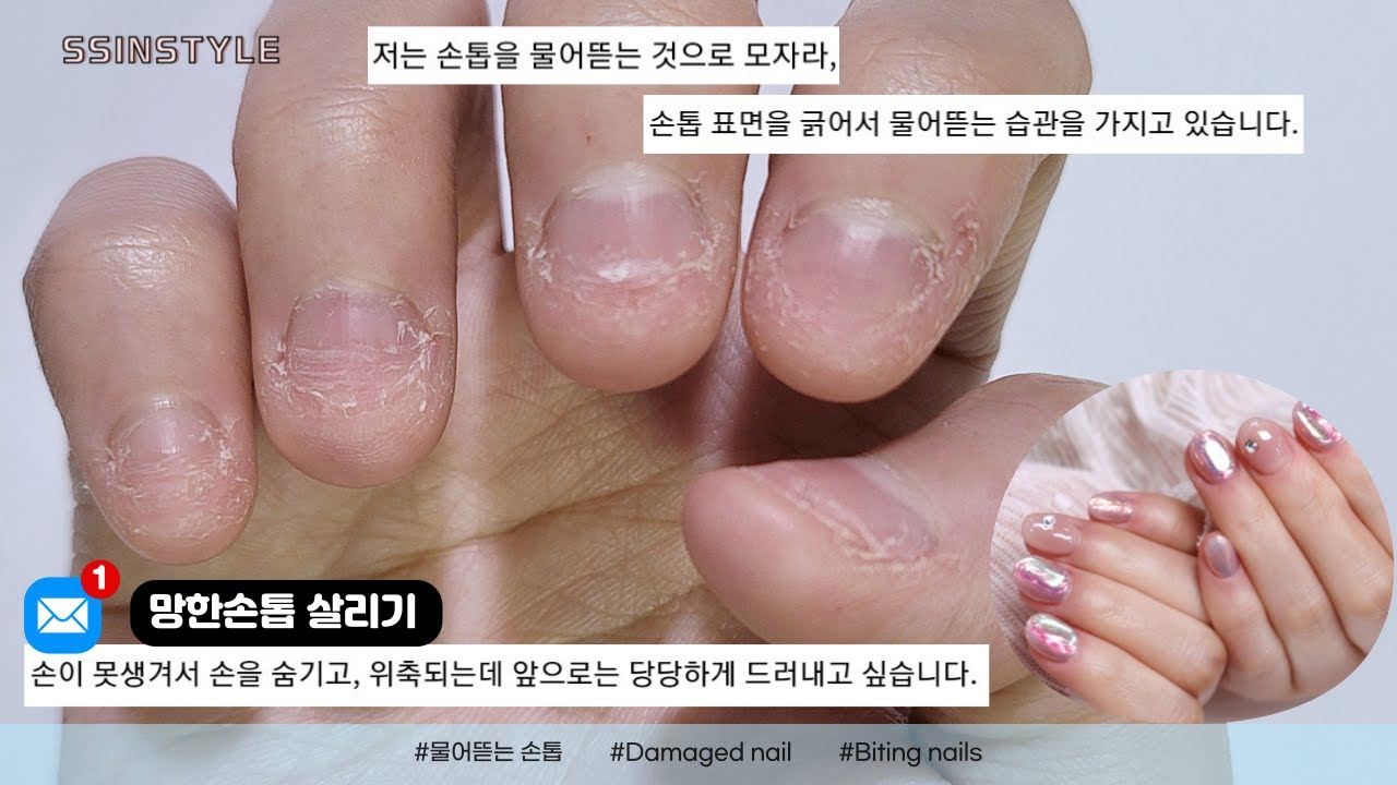 Eng sub) 18년을 물어뜯은 망한손톱 지원자...이번엔 꼭 성공합시다😭/협찬제품포함