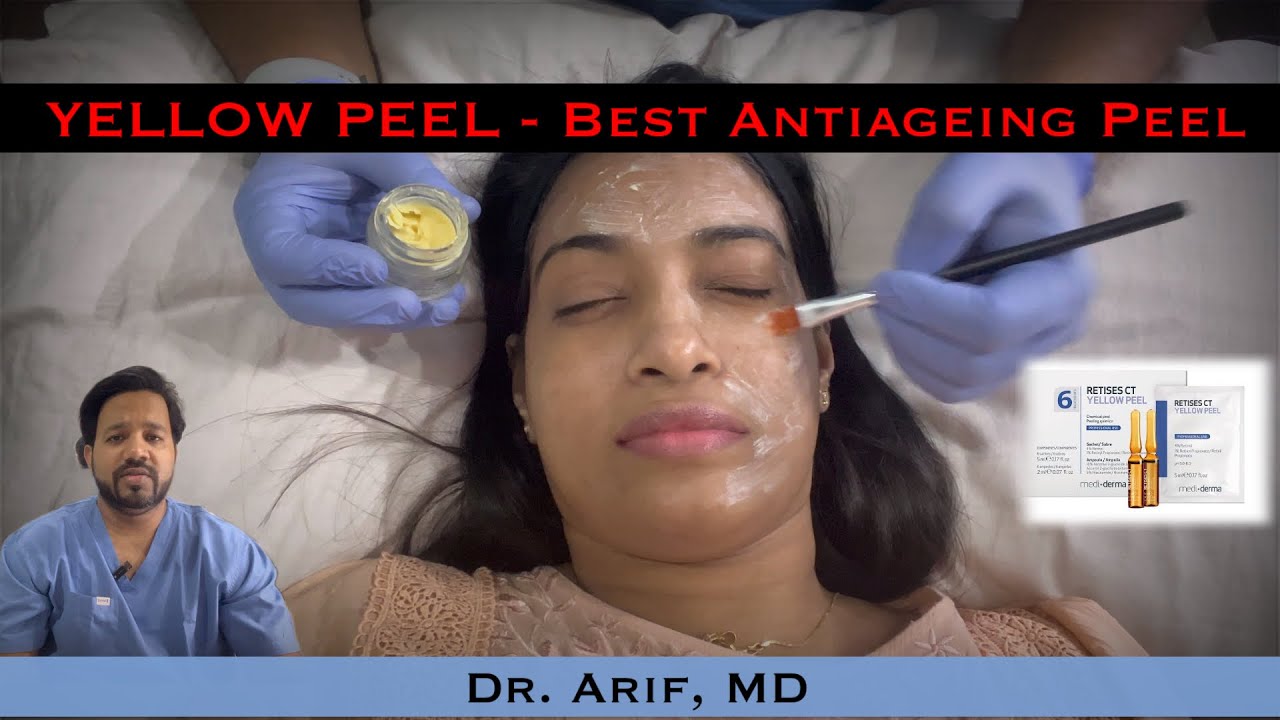Желтый пилинг (ретинол): лучший антивозрастной пилинг от DrArifMDDermatologist #желтыйпилинг #ухо...