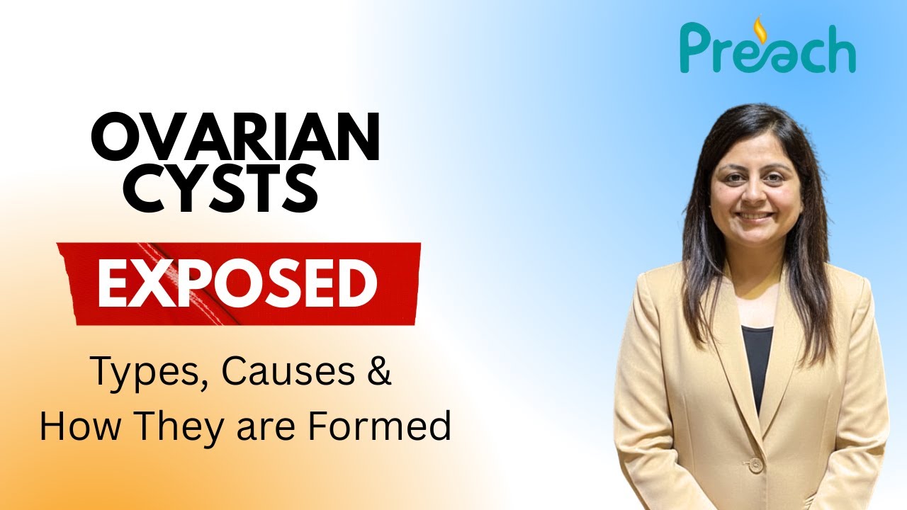 Ovarian Cysts Exposed : Types, Causes & How they are formed || Dr. Bhavneet Kaur 