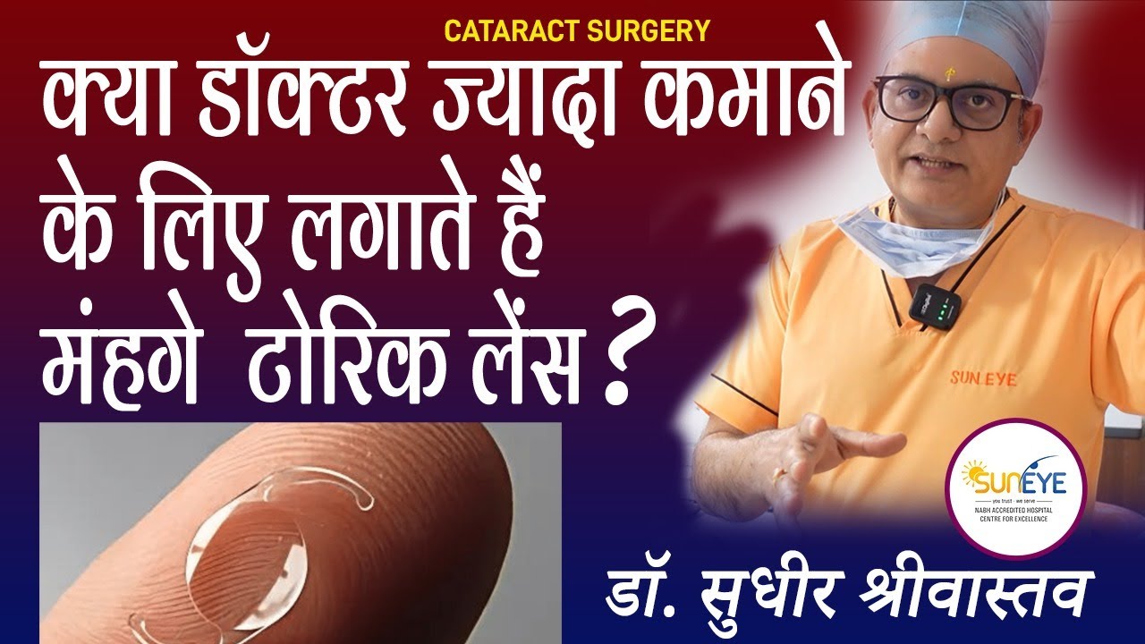 Toric lenses for cataract surgery, Toric lenses for astigmatism, Toric cataract surgery #suneyecafe