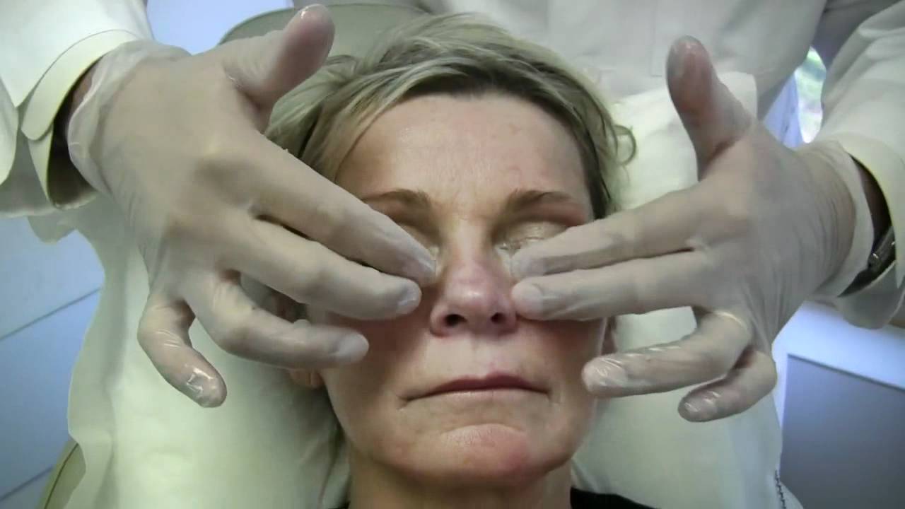 Dr. Janjua - Sculptra Injection Part 3 of 3 - New Jersey