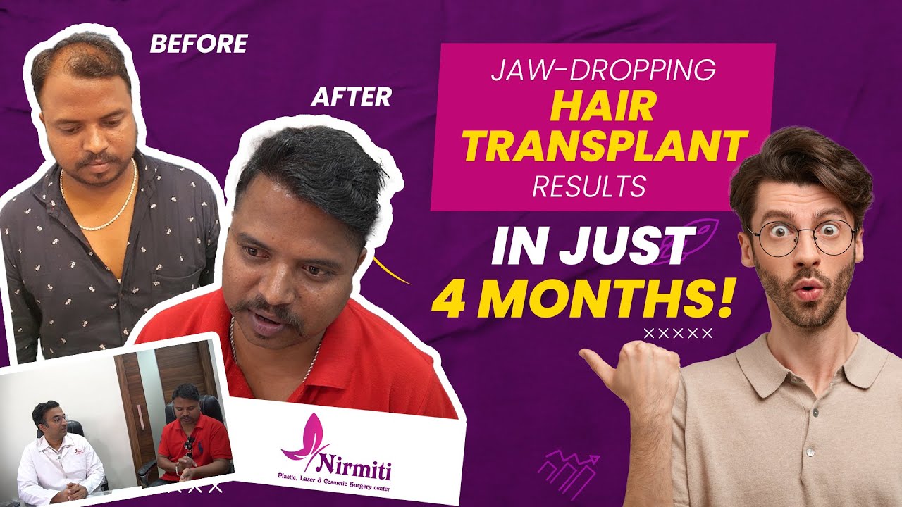 𝐇𝐚𝐢𝐫 𝐓𝐫𝐚𝐧𝐬𝐩𝐥𝐚𝐧𝐭 || 𝐇𝐚𝐩𝐩𝐲 𝐂𝐥𝐢𝐞𝐧𝐭 || 𝐁𝐞𝐬𝐭 𝐇𝐚𝐢𝐫 𝐆𝐫𝐨𝐰𝐭𝐡 𝐢𝐧 𝐑𝐞𝐜𝐨𝐯𝐞𝐫𝐲 𝐭𝐢𝐦𝐞 || 𝐅𝐫𝐢𝐞𝐧𝐝'𝐬 𝐒𝐮𝐠𝐠𝐞𝐬𝐭𝐢𝐨𝐧 𝐇𝐞𝐥𝐩𝐞𝐝