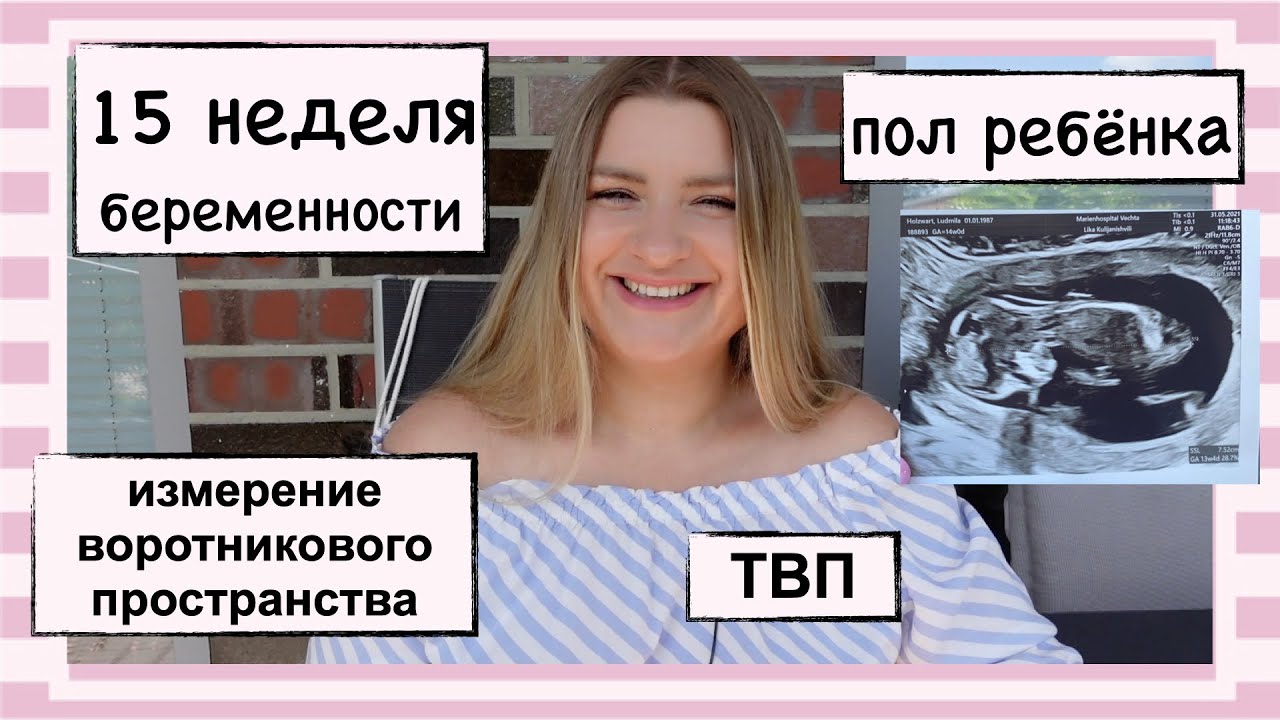 15 НЕДЕЛЯ БЕРЕМЕННОСТИ // РЕЗУЛЬТАТЫ СКРИНИНГА // ТОЛЩИНА ВОРОТНИКОВОГО ПРОСТРАНСТВА