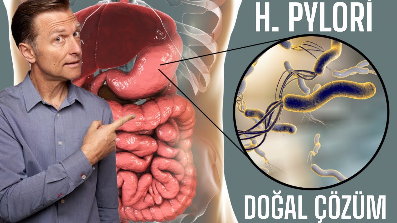 Helicobacter Pylori'ye (H. Pylori) Karşı 6 Doğal &Ccedil;&ouml;z&uuml;m | Dr.Berg T&uuml;rk&ccedil;e