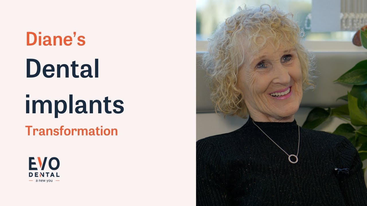 Diane's Dental Implant Transformation - Smile in a Day