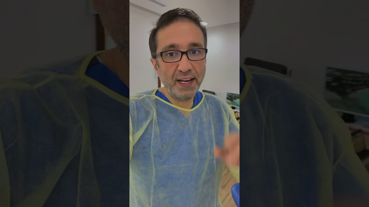 الدايركت فينير