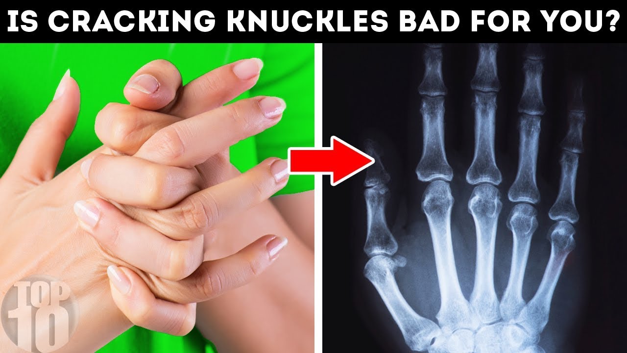 What Happens When You Crack Your Knuckles?