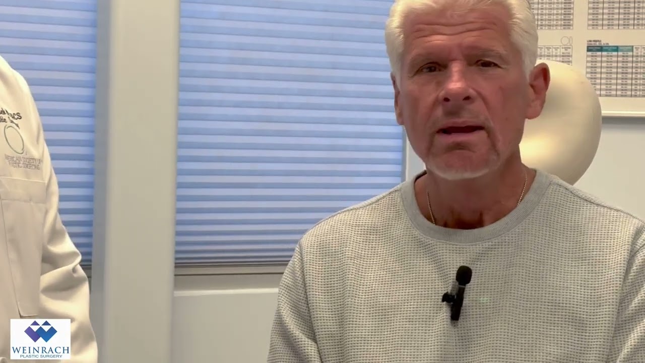 Male Neck Lift Review