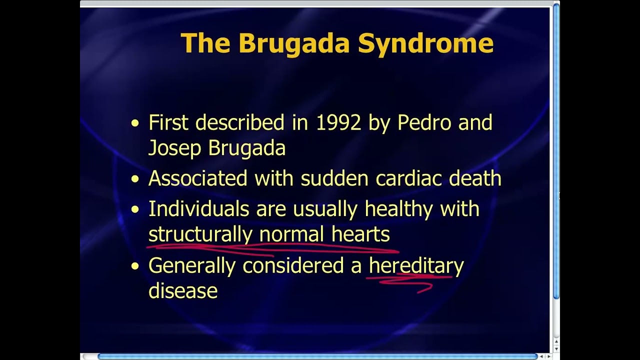 Amal Mattu's ECG Case of the Week_ July 28, 2014