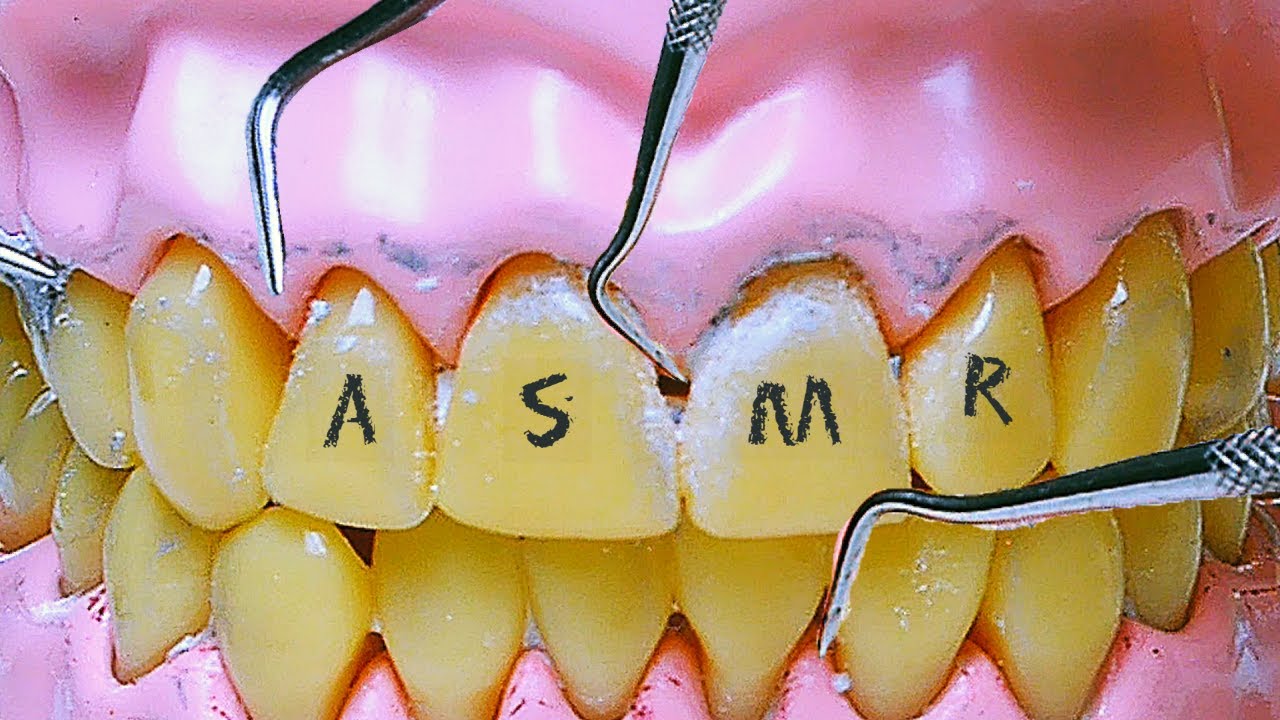 Deep Teeth Cleaning ASMR (No Talking)