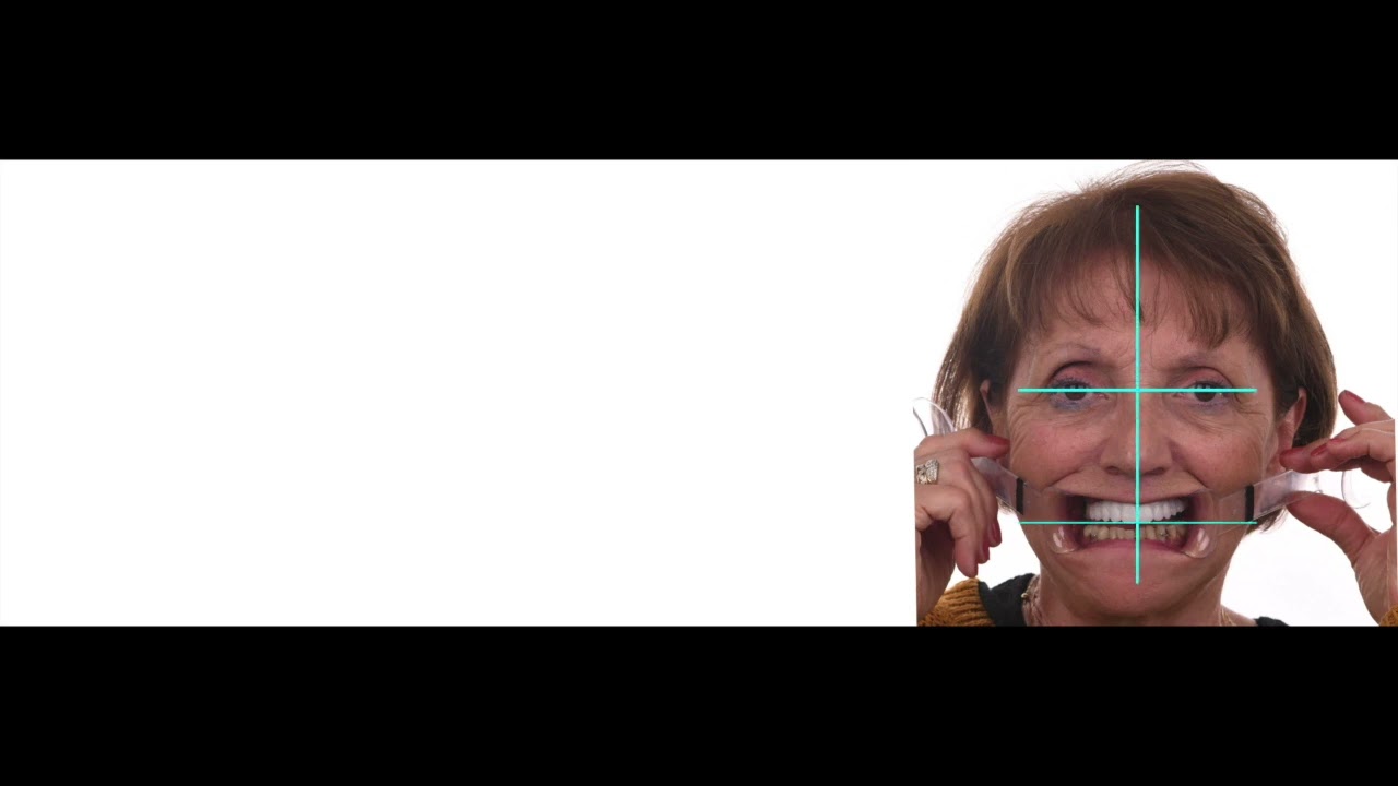 CAS CLINIQUE Complet de réhabilitation 2019