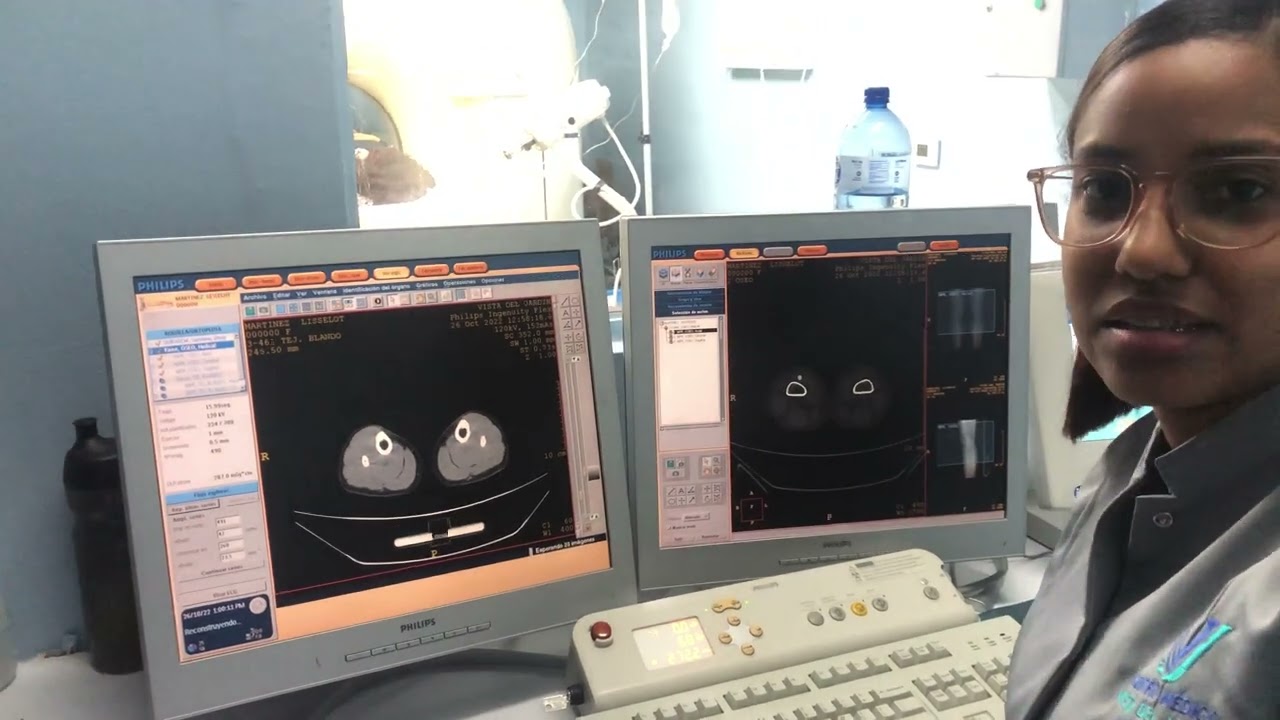Cómo realizar una tomografía de rodilla y reconstrucción 3D.