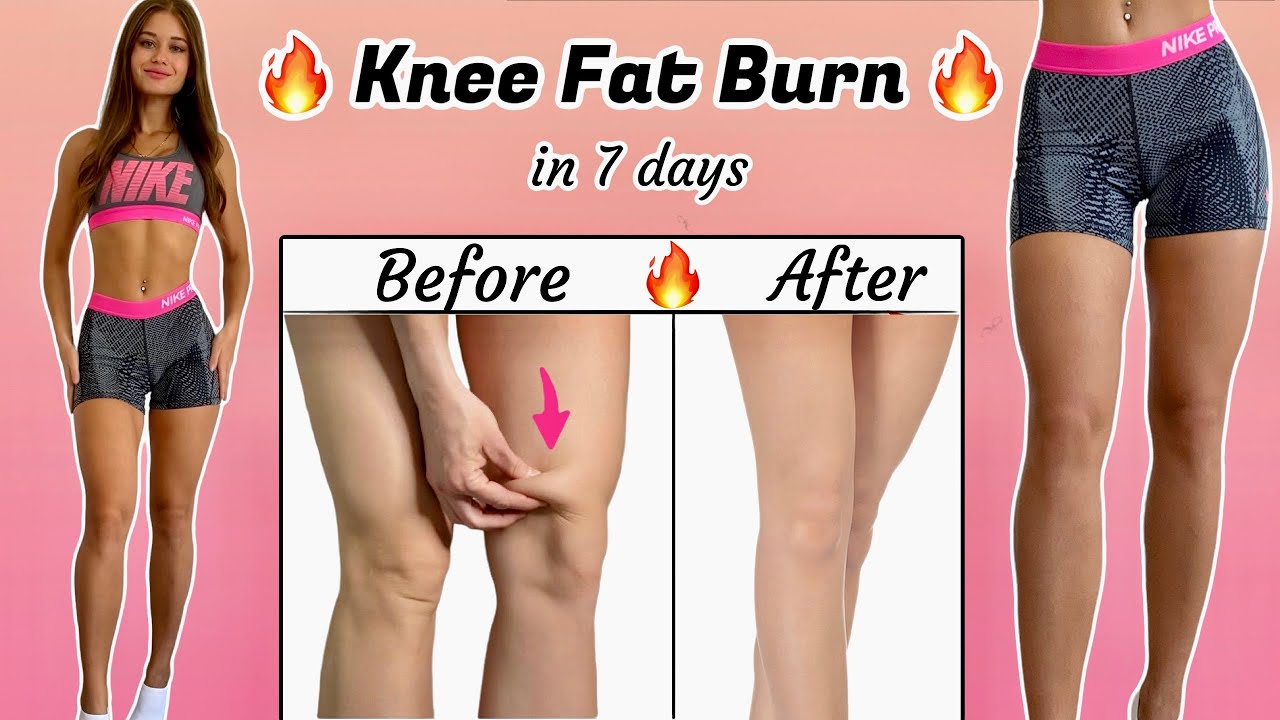 KNEE FAT BURN WORKOUT 🔥 Get TONED Model Legs in Just 5 min Daily 🔥 No Squats, No Jumping