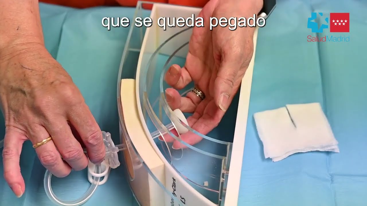 Hospital Gregorio Mara&ntilde;&oacute;n - Gastrostom&iacute;a Endosc&oacute;pica Percut&aacute;nea. Sonda de Primera Puesta
