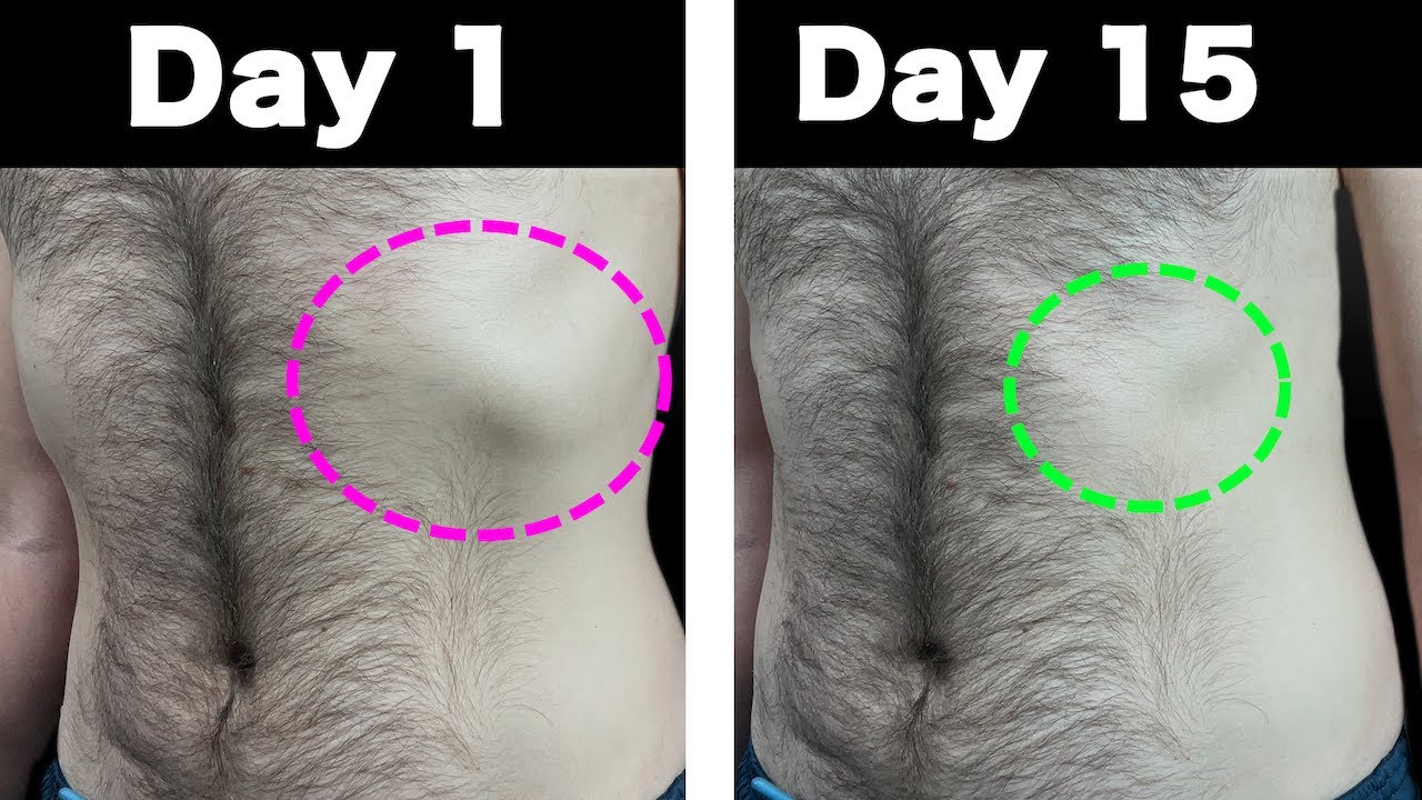 The BEST Rib Flare Fix