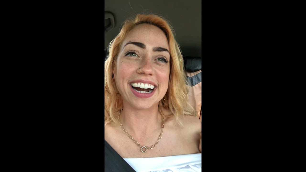 Coronectomy/Wisdom Tooth Adventure