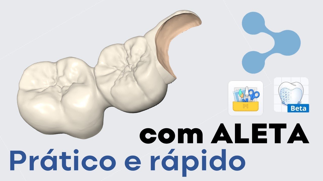 Design rápido com Aletas na prótese fixa - Medit Link