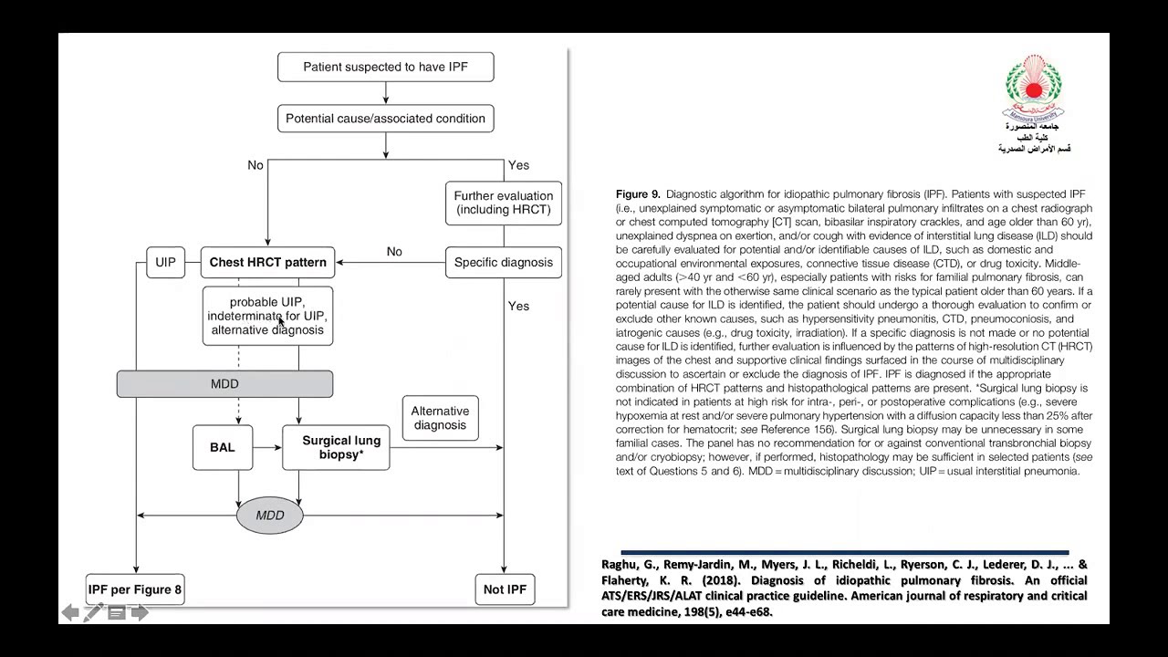 Interstitial Lung Disease Part 1 (IPF) | WEBinar (Arabic)
