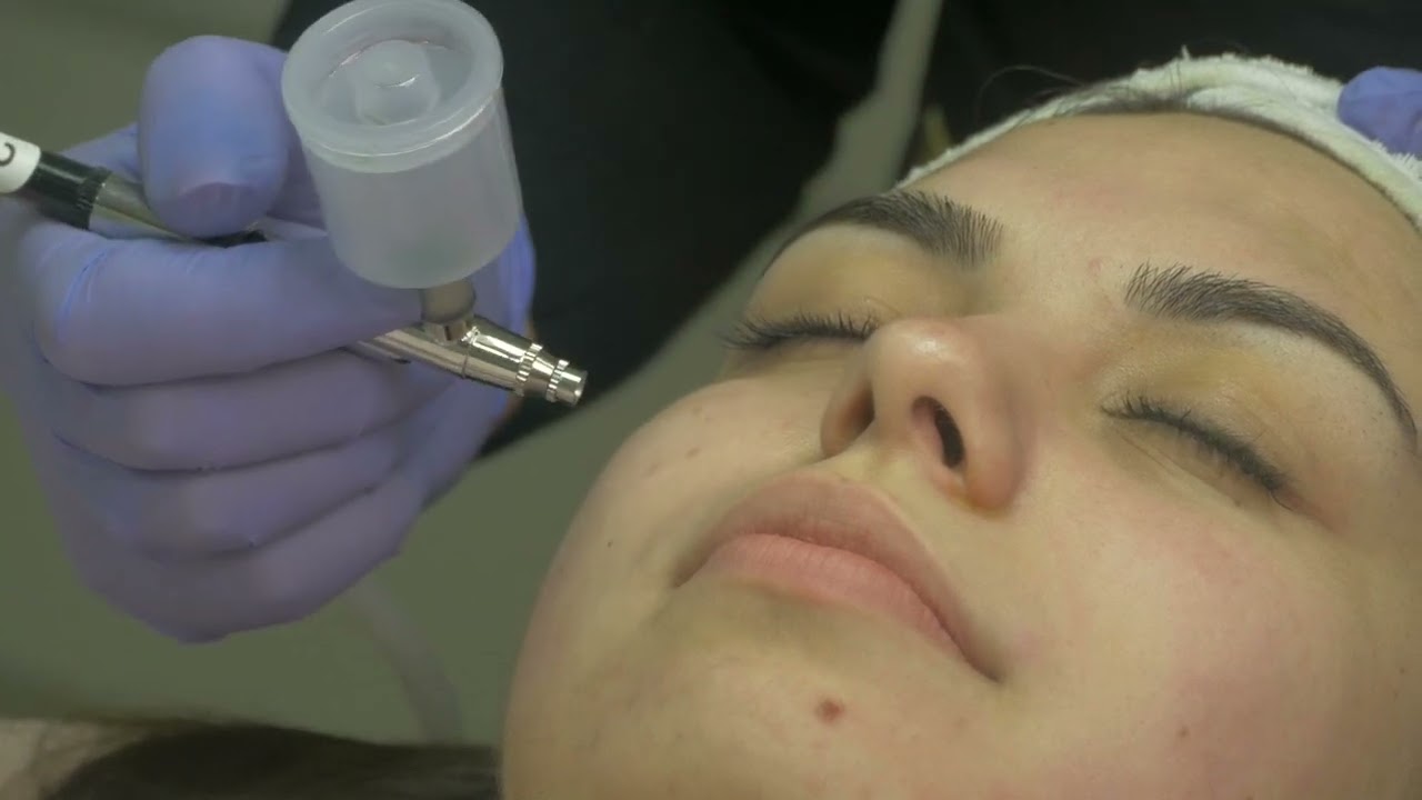 TRETMAN - Kiseonikom