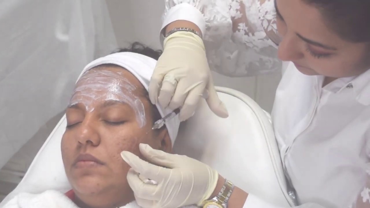 Scar filler treatment - Christell Skin Clinic