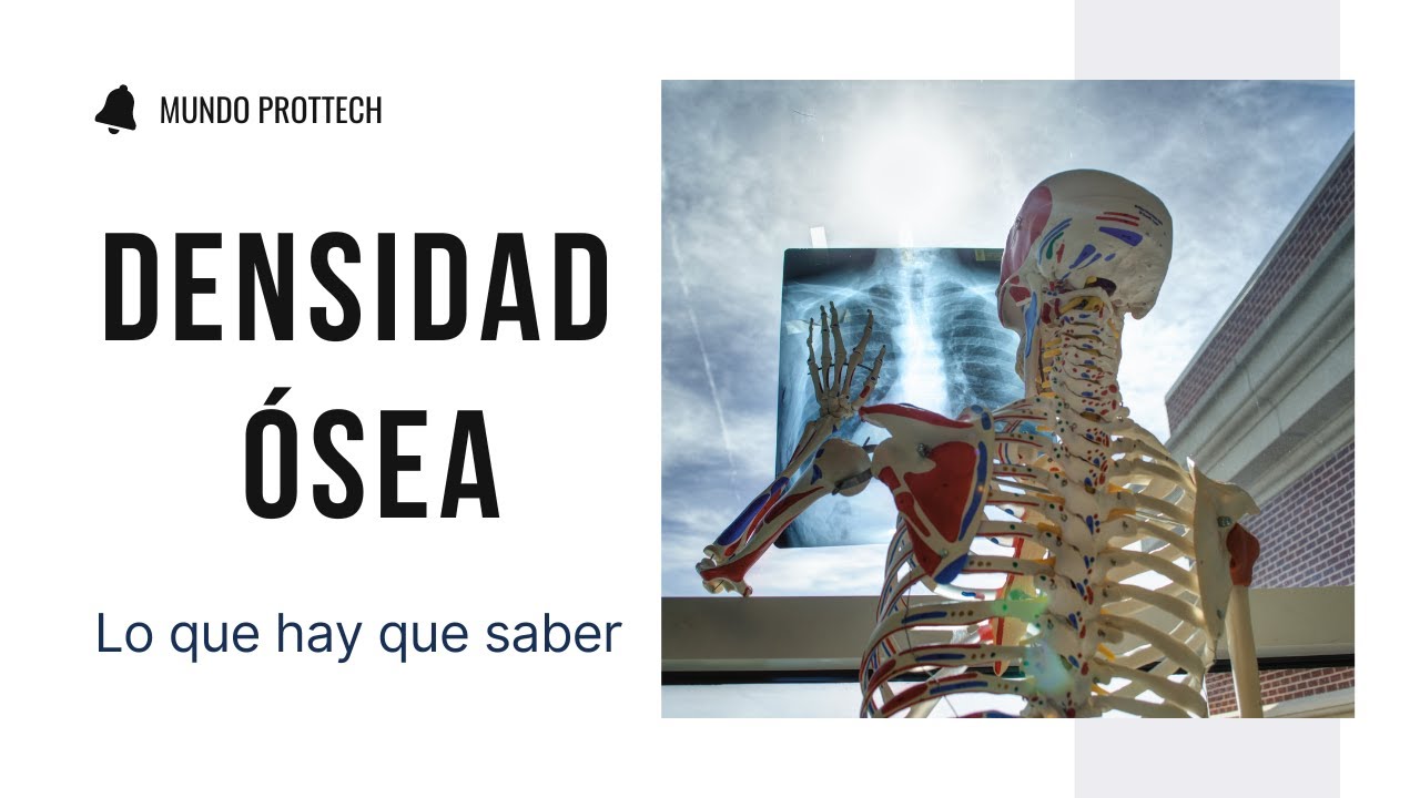 Densidad &oacute;sea #densidad&oacute;sea #osteopenia #osteoporosis