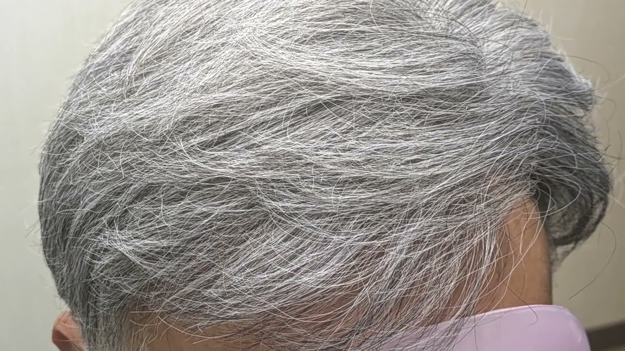 編み込み法のウイッグを実際に取り付けている動画をお見せいたします。ビフォーアフターもご覧ください。習得に５年ほどはかかる技術です。
