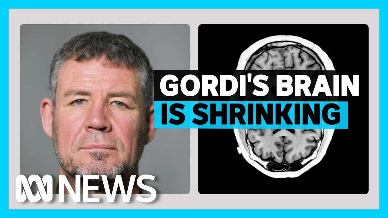 Inside the brain of a suspected CTE patient | ABC News