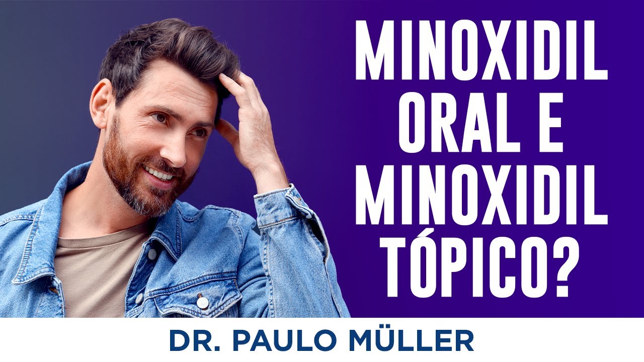 Vale a pena usar Minoxidil Oral e Tópico juntos?  - Dr. Paulo Müller Dermatologista.