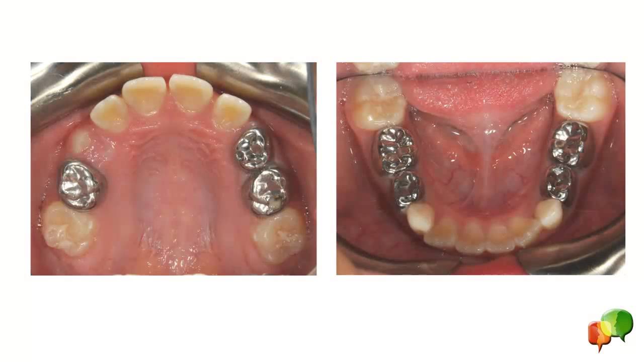 Serial Extraction Answer