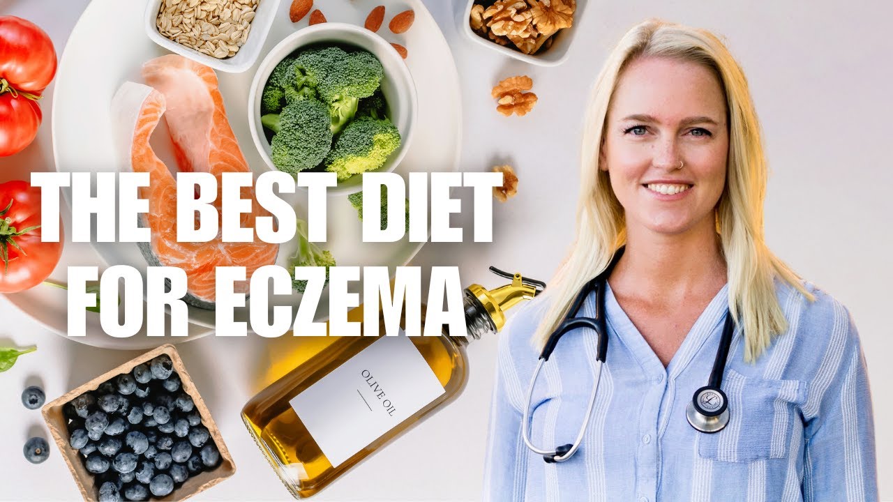 Best Diet for Eczema | The Diet I Eat to Heal Eczema Naturally