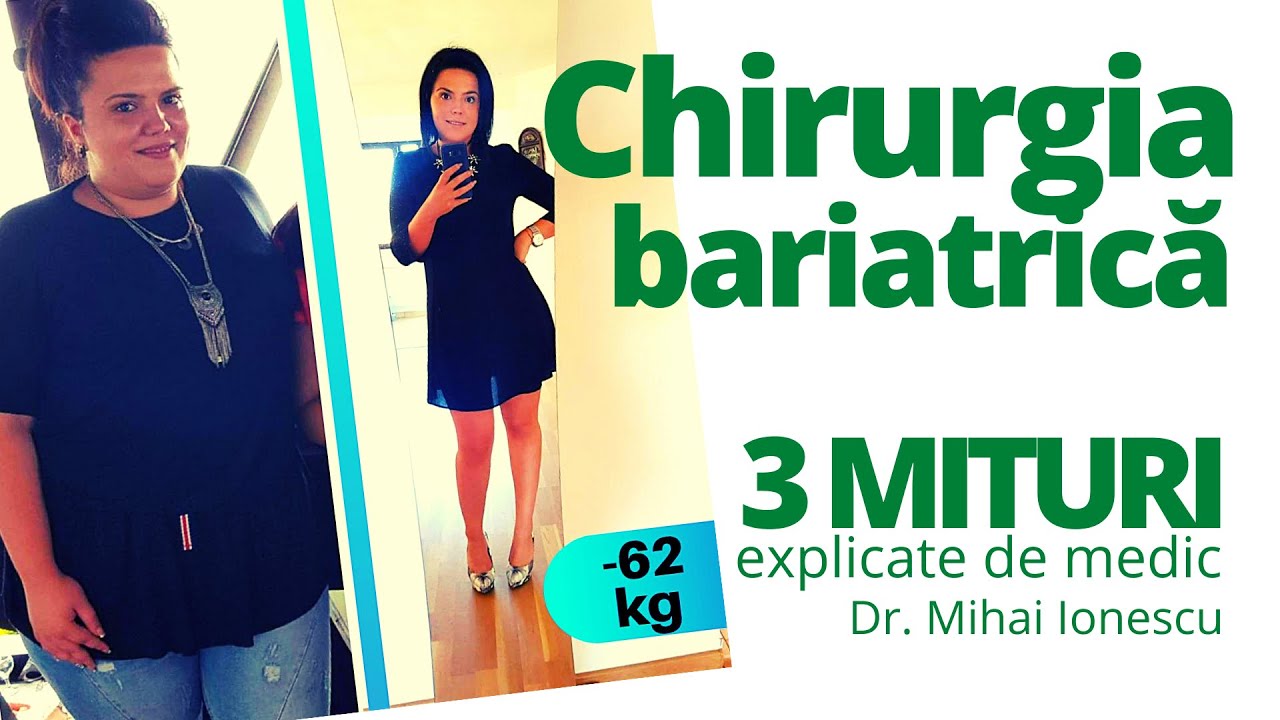 Operatia de micsorare a STOMACULUI:  3 Mituri demontate de MEDIC