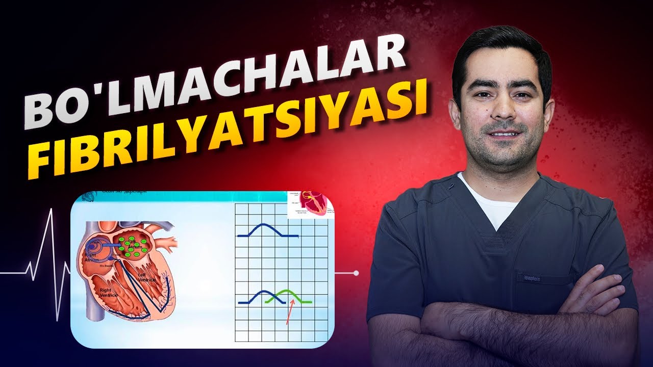 Bo'lmachalar fibrilyatsiyasi bo’yicha to’liq ma’lumot...  #arrhythmia #taxikardiya #yurak