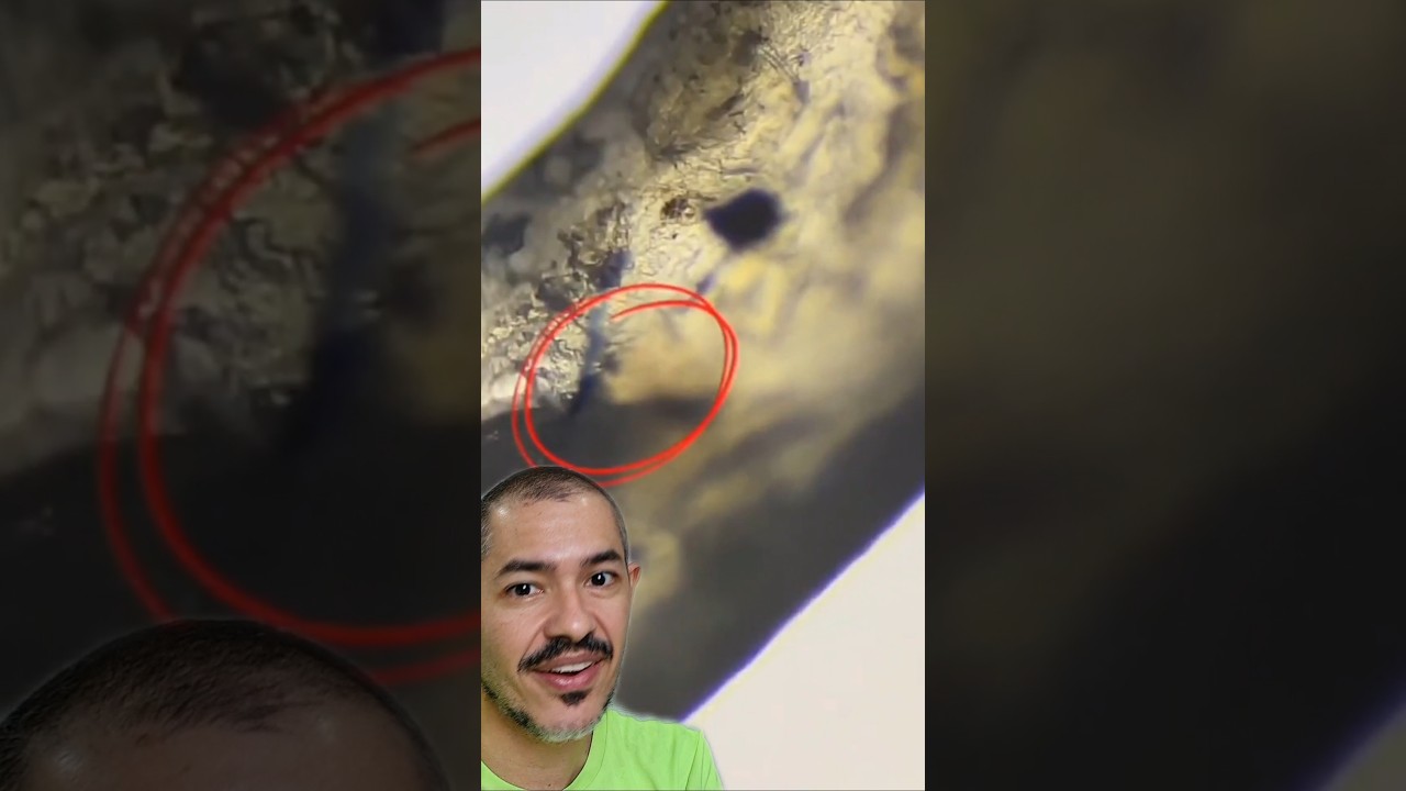 Unha no Microsc&oacute;pio | E essa sujeira estranha a&iacute;?