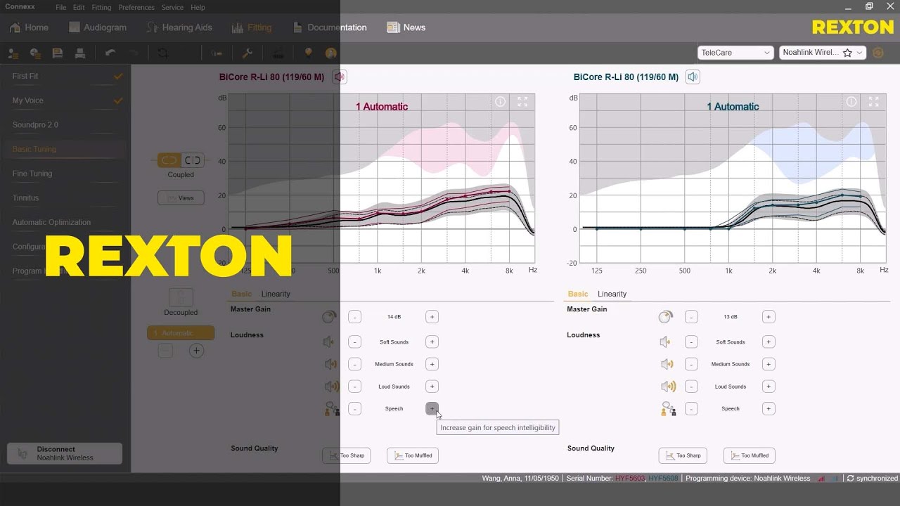 Troubleshooting through basic tuning in Connexx | REXTON Hearing Aids