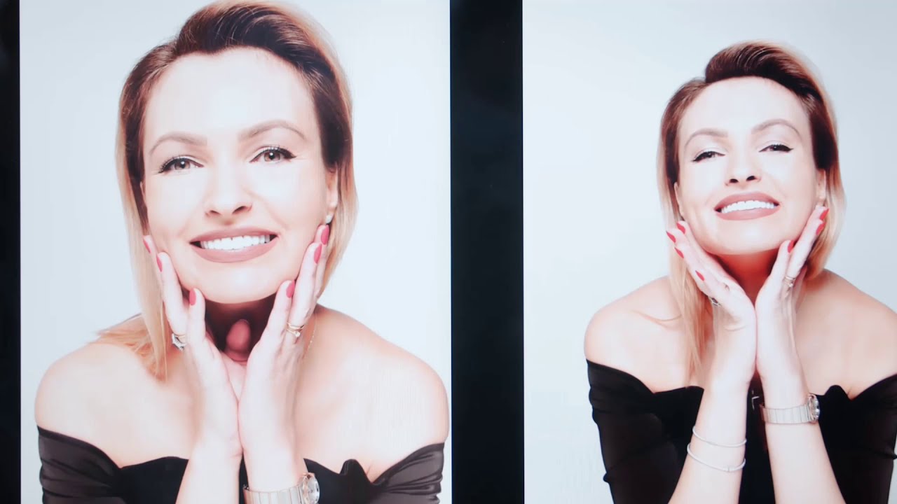 DENTAL EXPERTS - SMILE MAKEOVER - DR. SERGIU ANTONIE