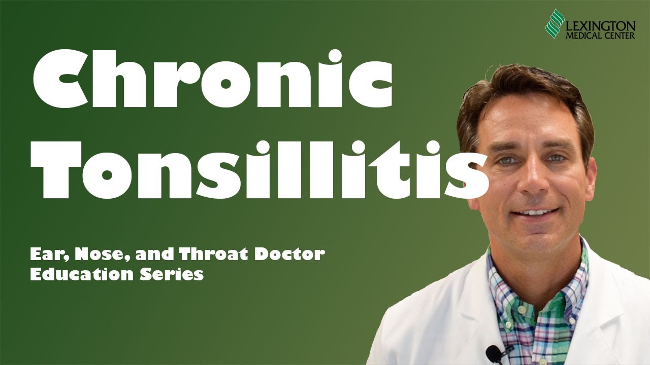 Chronic tonsillitis