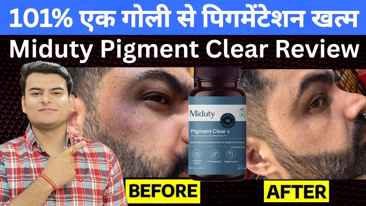 miduty pigment clear review | Pigmentation and Melasma Removal Capsules | miduty pigment clear