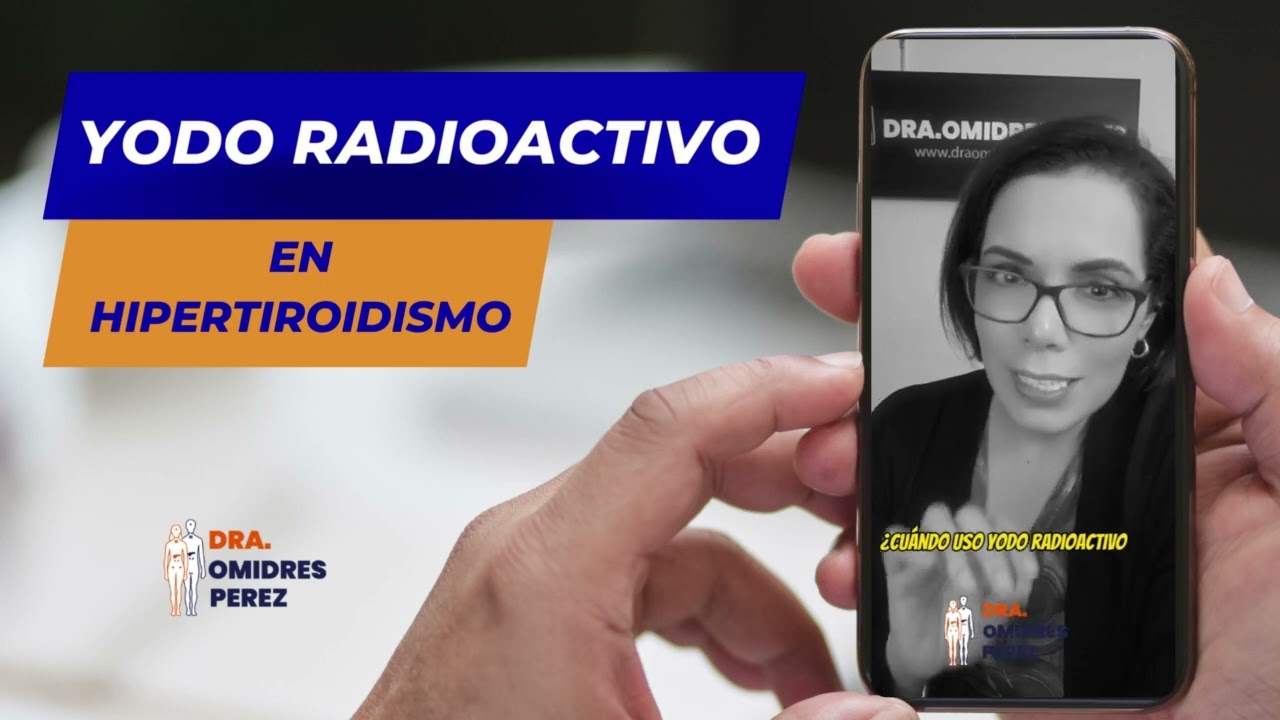 Dudas sobre el yodo radioactivo en hipertiroidismo