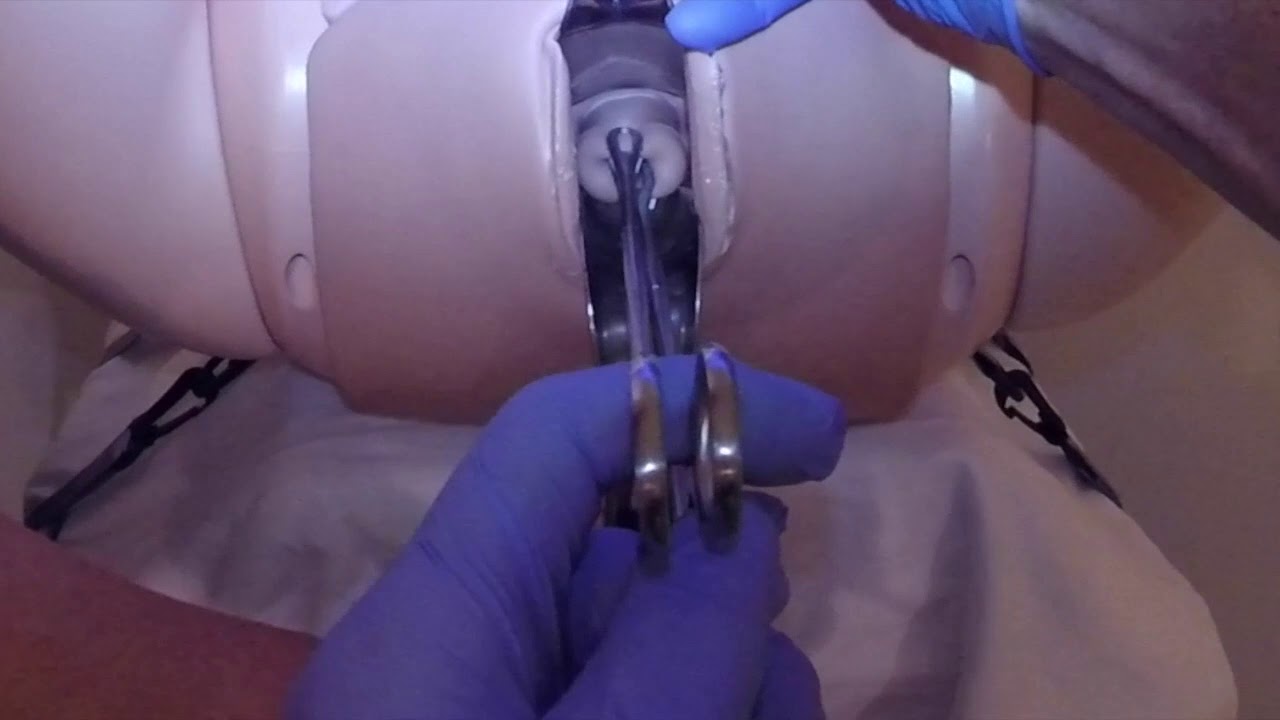 Elective / Scan Indicated Cerclage on our  Limbs&Things simulator