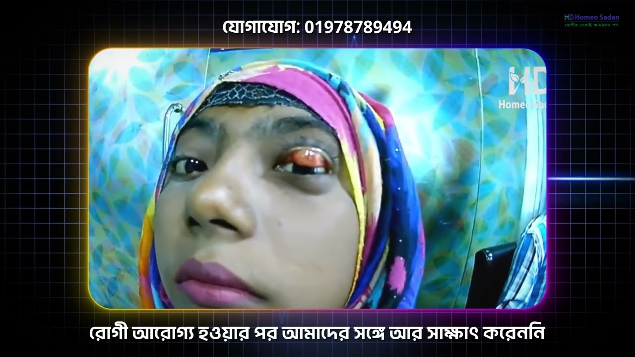 ৮ মাসের পুরাতন অঞ্জনি | বহু চিকিৎসায় ব্যর্থ, অবশেষে সম্পূর্ণ সুস্থ | HD Homeo Sadan