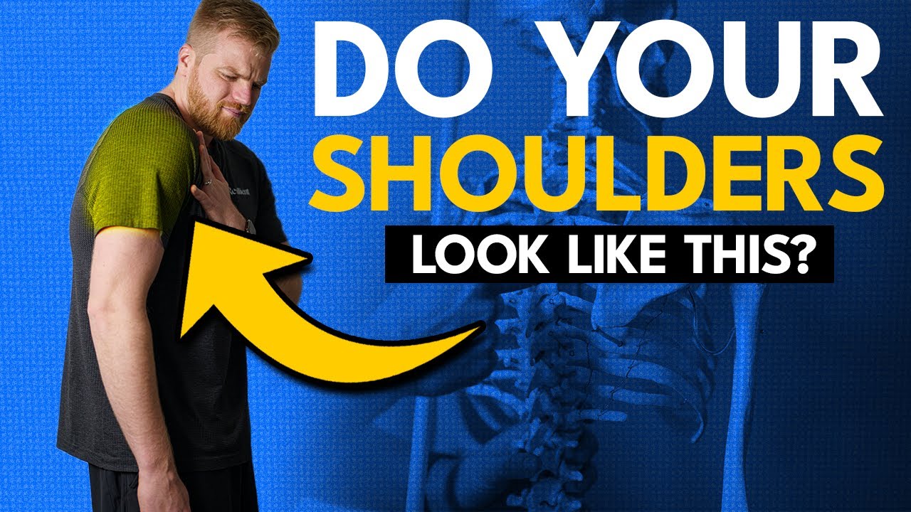 How to FIX Rounded Shoulders Fast: The Ultimate Posture Solution