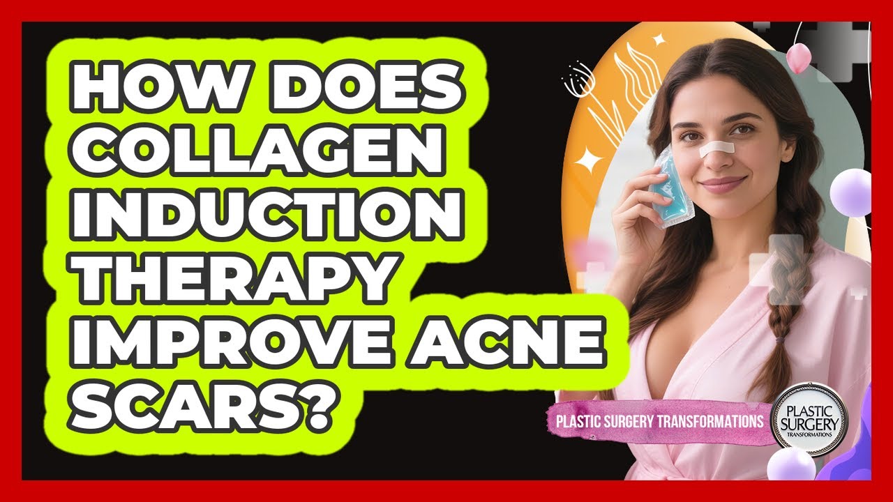 How Does Collagen Induction Therapy Improve Acne Scars? - Plastic Surgery Transformations