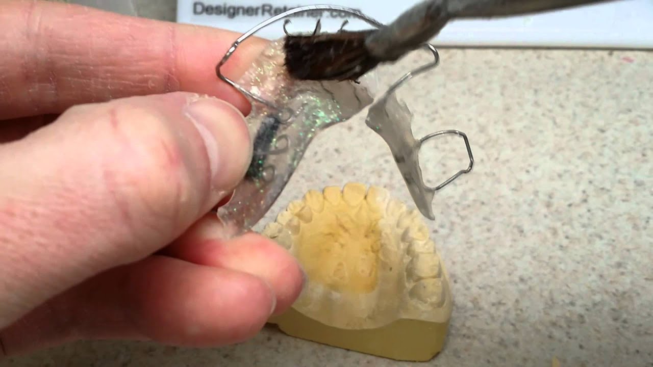 Retainer Repair
