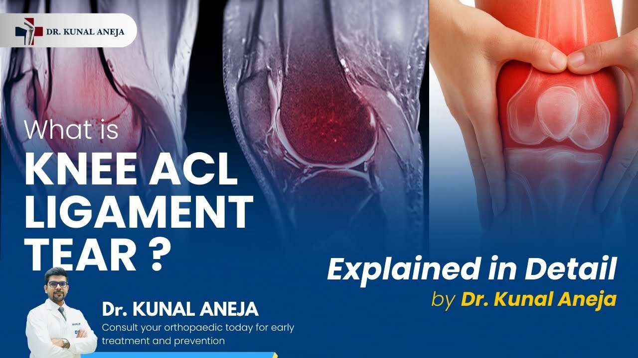 What Is an ACL Tear? | Knee ACL Ligament Injury Explained in Detail - Dr. Kunal Aneja,Sports Surgeon