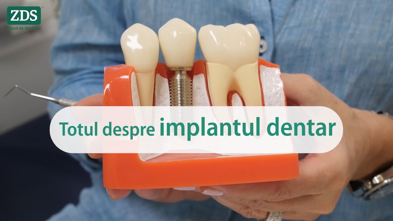 Totul despre implantul dentar, cu Dr. Anca Vereanu