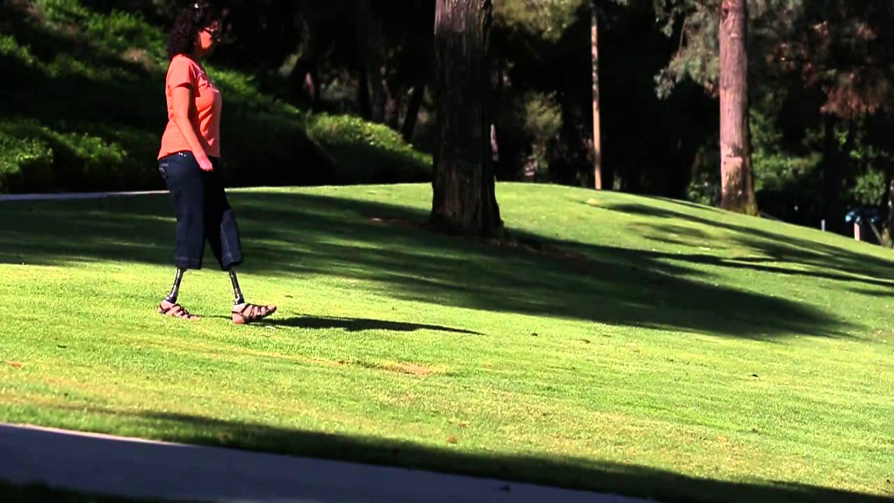 Kinterra Transtibial Clips