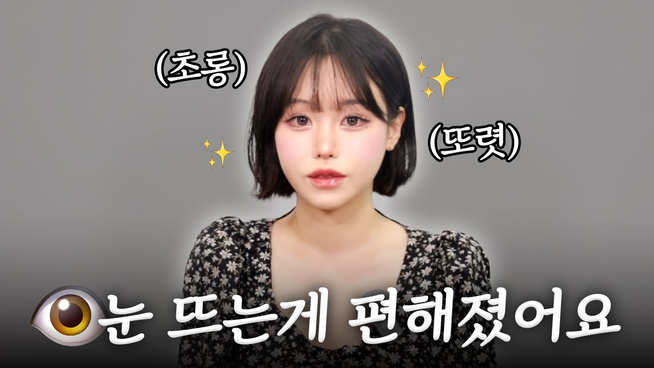 이마거상 후 1년이 지나면 생기는 일 ㅣ 20대 이마거상, 30대 이마거상